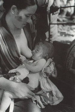 被爆後、我が子に乳を含ませる母